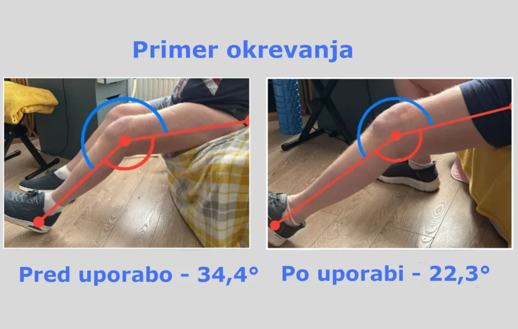 Spremljanje napredka